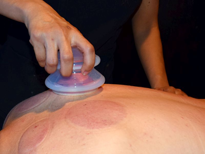 Manually Cupping On Back