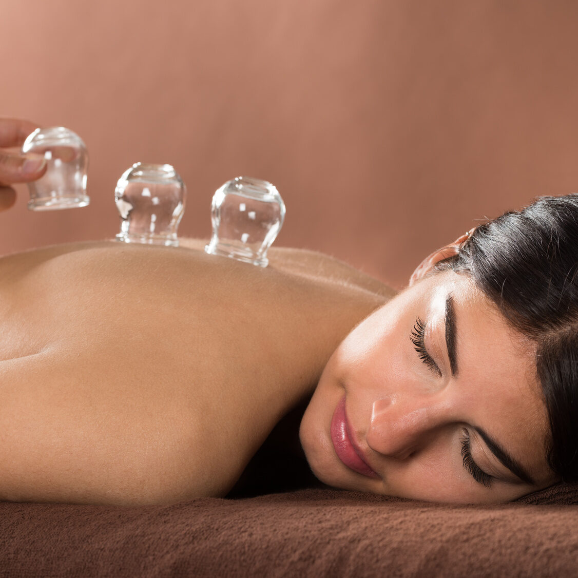 Woman Getting Cupping Treatment At Spa